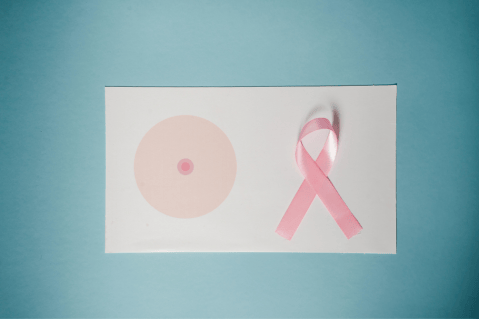 La detección temprana del cáncer de mama mejora la supervivencia en un 85%