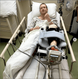 Mark Zuckerberg fue hospitalizado tras lesionarse mientras entrenaba