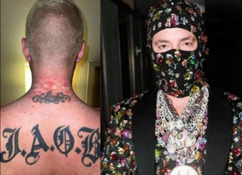 ¡Qué dolor! Así quedó cuello de J Balvin tras portar pesadas cadenas en MET Gala.