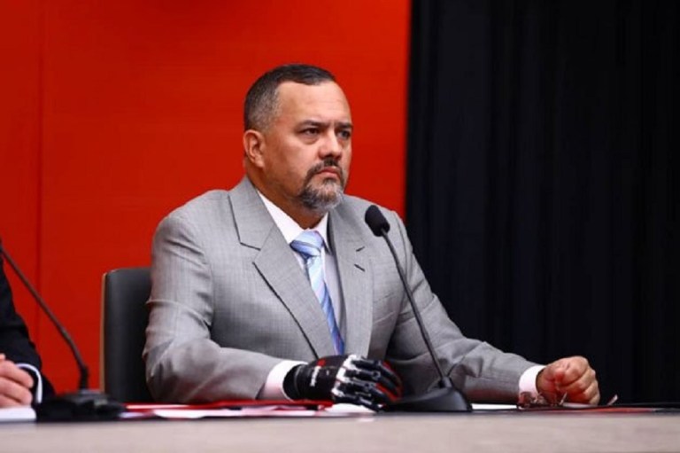 Hermano de Diosdado Cabello usa una mano biónica valorada entre 20 y 35 mil dólares