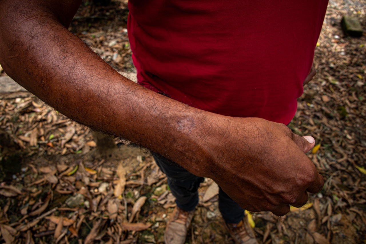 Investigaciones han mostrado que hay una correlación entre la presencia de la leishmaniasis con procesos de deforestación. / Fotos: Ignacio Galán