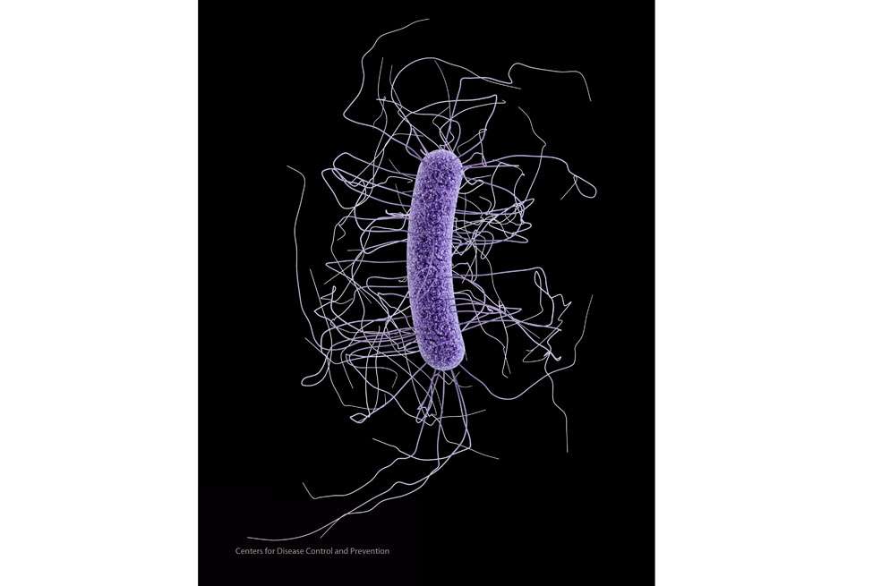 Trasplantes de heces se usan para tratar infecciones por Clostridium difficile.