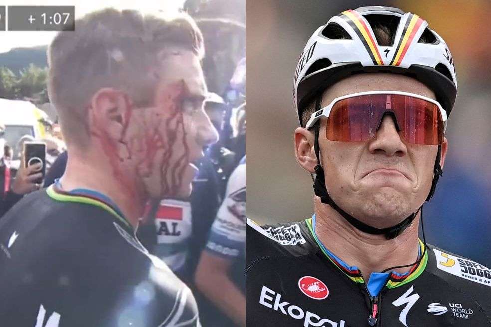 Así quedó Remco Evenepoel tras su grave caída en la Vuelta a España, luego de su triunfo en la tercera etapa.