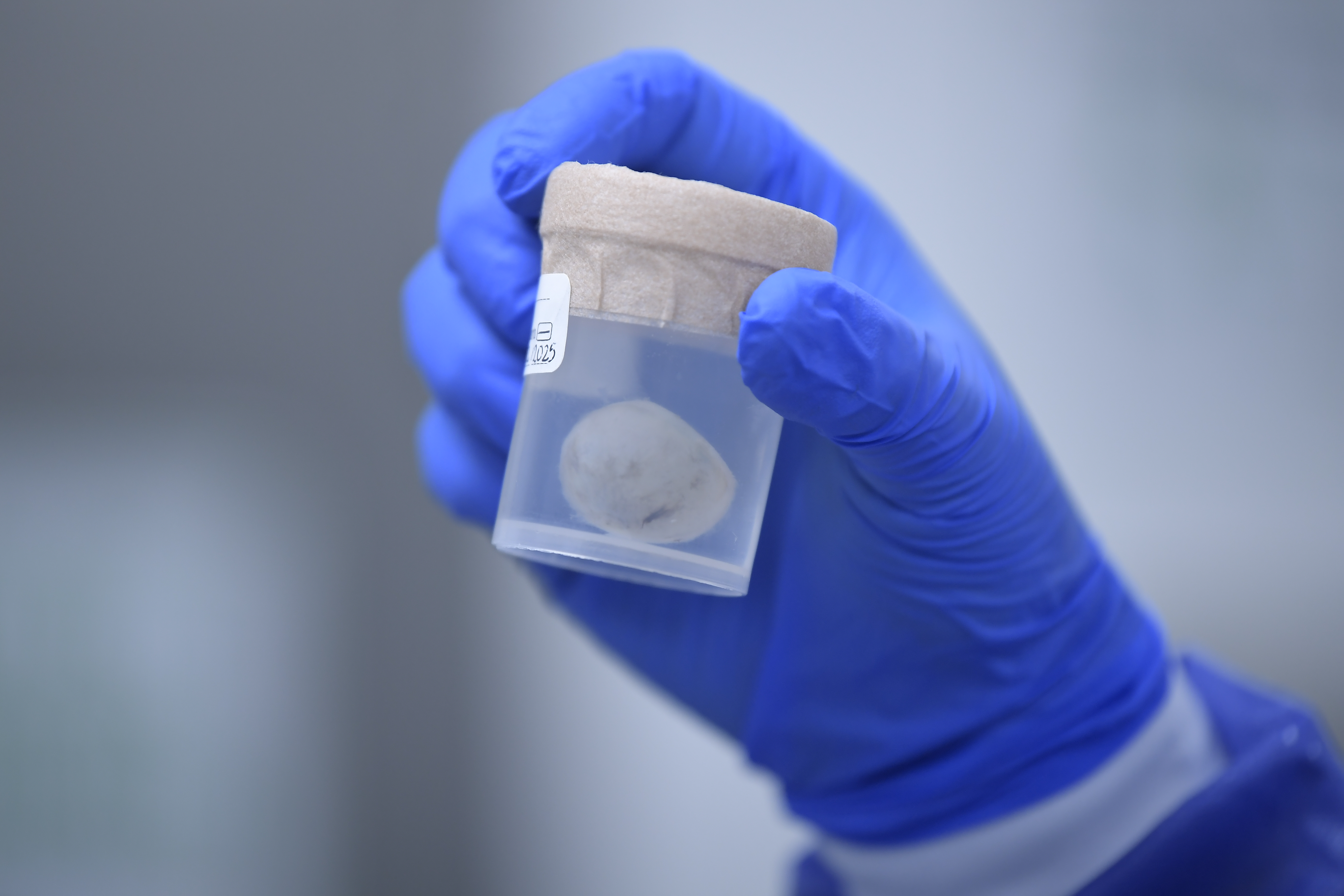Banco de donantes, rescate, procesamiento, preservación, almacenamiento y distribución de tejidos humanos como osteo-musculares, ocular, piel y membrana amniótica con fines de implante.