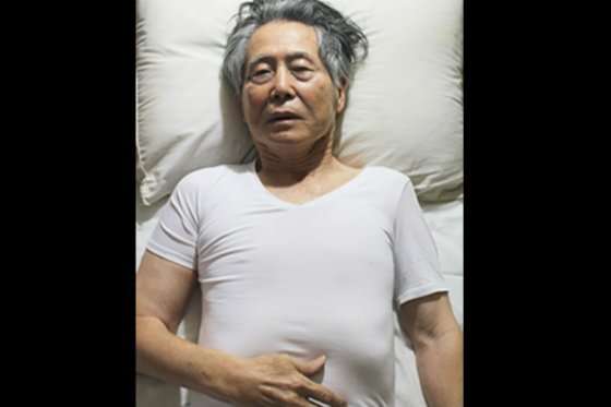 Padece una gastroduodenitis erosiva