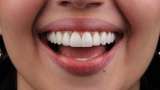 Los dientes gigantes no son la solución: ¿cómo lograr un diseño de sonrisa natural?