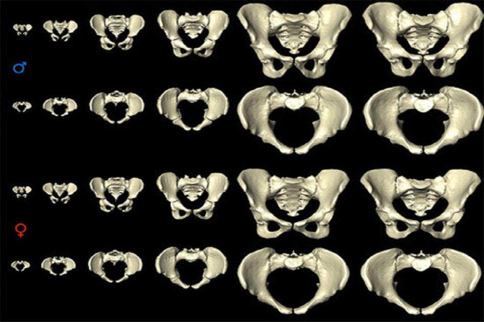 Desarrollo de la pelvis humana desde el nacimiento hasta los 80 años. / MorphoLab, University of Zurich