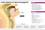 Sexo oral y su relación con el cáncer
