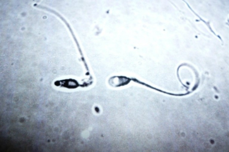 Ya se puede medir la fertilidad del semen con un celular