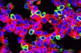 Científicos eliminan el gen causante de una enfermedad pulmonar mortal en ratones