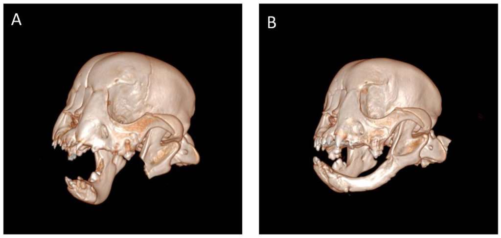 Las imágenes de 3D de Tyson muestran su mandíbula extirpada (izquierda) y ocho semanas después (derecha) con la mandíbula regenerada.
