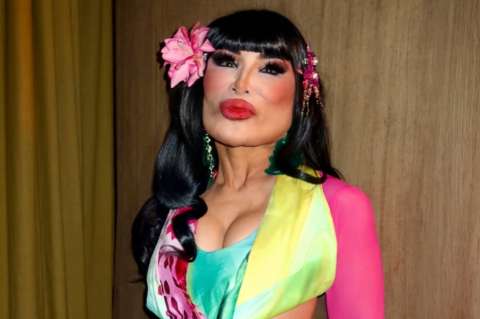 Lyn May contó la verdad de la transformación de su rostro: “Terrible”. Así se veía antes