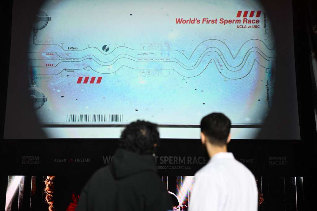 People watch a visualization of the sperm race between Noah Boat and YouTuber Jimmy Zhang during the undercard Sperm Racing competition in Los Angeles, California on April 25, 2025. Tristan Mykel of USC holds a golden sperm trophy after winning the Sperm Racing competition championship in Los Angeles, California on April 25, 2025.