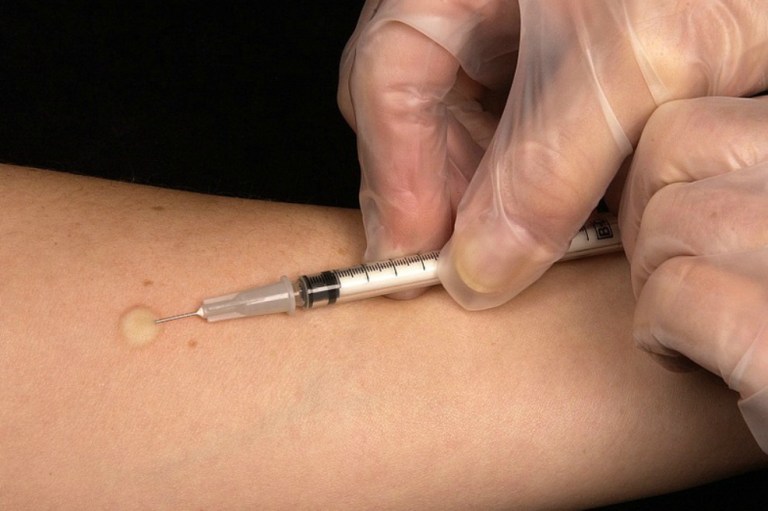 Una de cada tres personas que se inyecta drogas tiene hepatitis C, según un estudio a nivel mundial