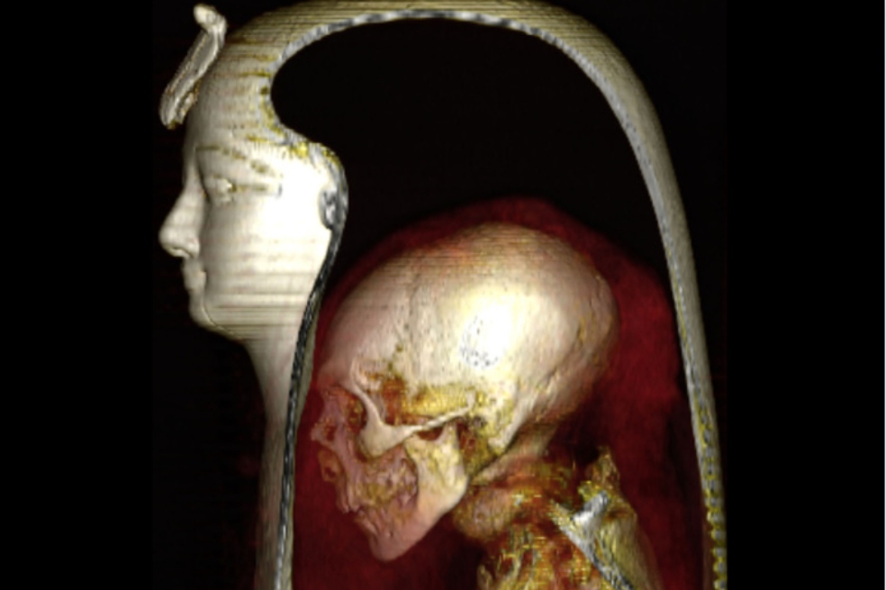 Imagen de TC tridimensional de la cabeza de la momia envuelta de Amenhotep I en una vista lateral izquierda que permite visualizar las capas que la componen: la máscara, la cabeza de la momia y los vendajes circundantes.