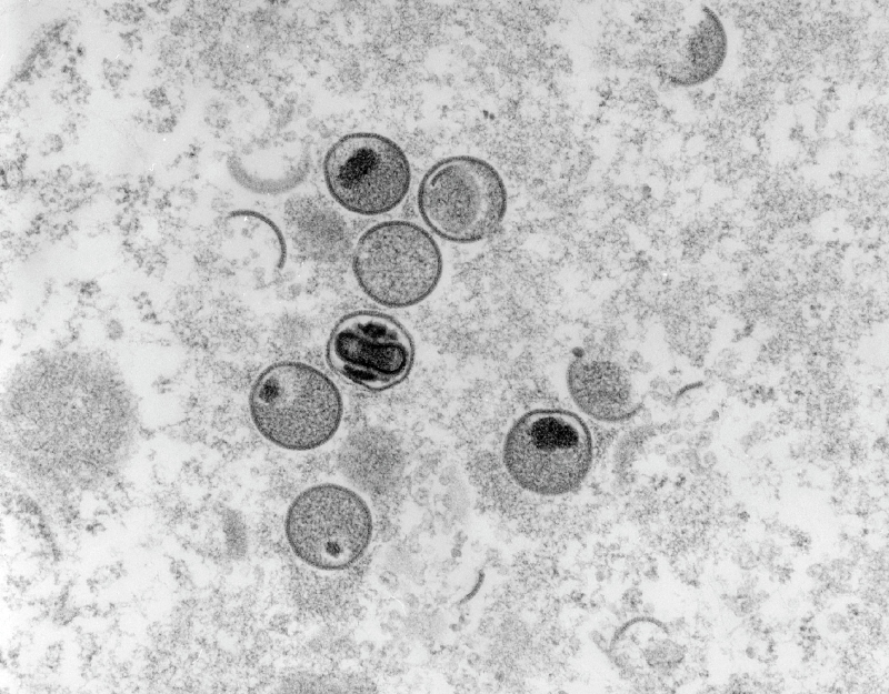 TO GO WITH AFP STORY BY CAMILLE BAS-WOHLERT - RESTRICTED TO EDITORIAL USE IN THE CONTEXT OF REPORTS ON THE MONKEYPOX VIRUS - MANDATORY CREDIT "AFP PHOTO / RKI / FREYA KAULBARS" - NO MARKETING NO ADVERTISING CAMPAIGNS - NO PERMISSION TO CHANGE THE MOTIF - D
