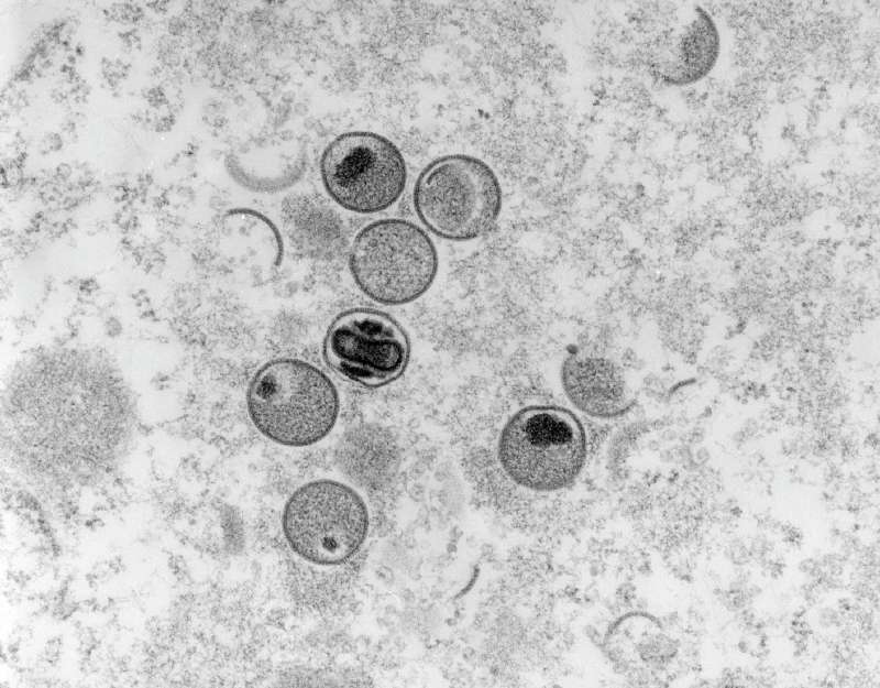 TO GO WITH AFP STORY BY CAMILLE BAS-WOHLERT - RESTRICTED TO EDITORIAL USE IN THE CONTEXT OF REPORTS ON THE MONKEYPOX VIRUS - MANDATORY CREDIT "AFP PHOTO / RKI / FREYA KAULBARS" - NO MARKETING NO ADVERTISING CAMPAIGNS - NO PERMISSION TO CHANGE THE MOTIF - D