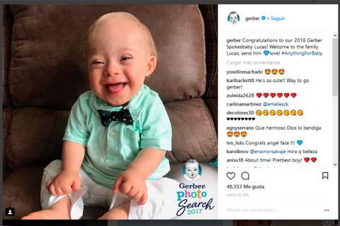 El primer bebé con síndrome de down que protagoniza campaña de compotas