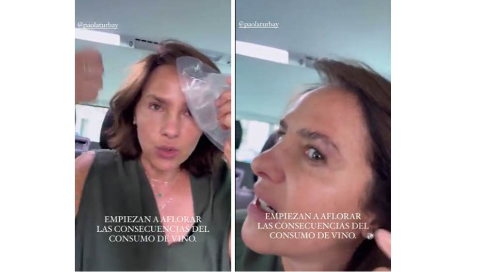 Paola Turbay sufrió accidente en España y mostró las consecuencias