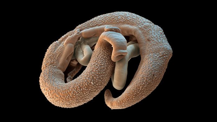 ¿Dejaría que una lombriz viviera dentro de su cuerpo, por la ciencia?