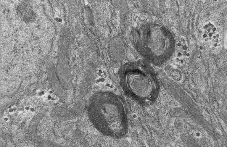 Descubren nuevo “orgánulo” celular en el intestino de un tipo de mosca