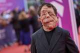 Adam Pearson: qué le pasó, por qué se le desfiguró el rostro y más del actor