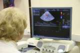 Avances en la detección precoz del cáncer de ovario