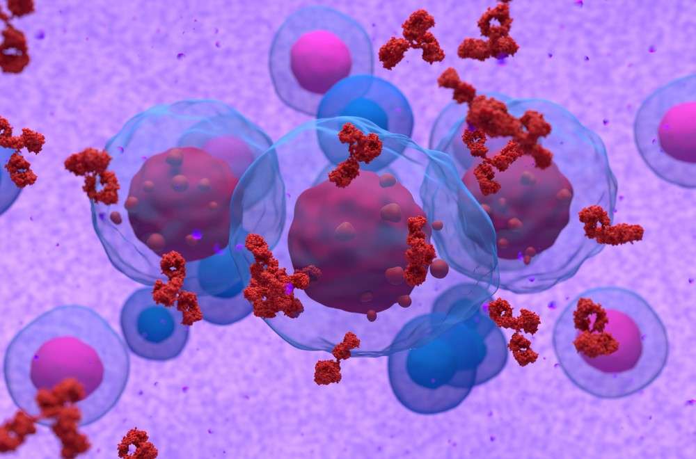 Entre los diferentes tipos de cáncer hematológico, se encuentra el mieloma múltiple.