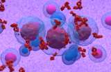 Mieloma múltiple, el segundo cáncer hematológico más frecuente en Colombia