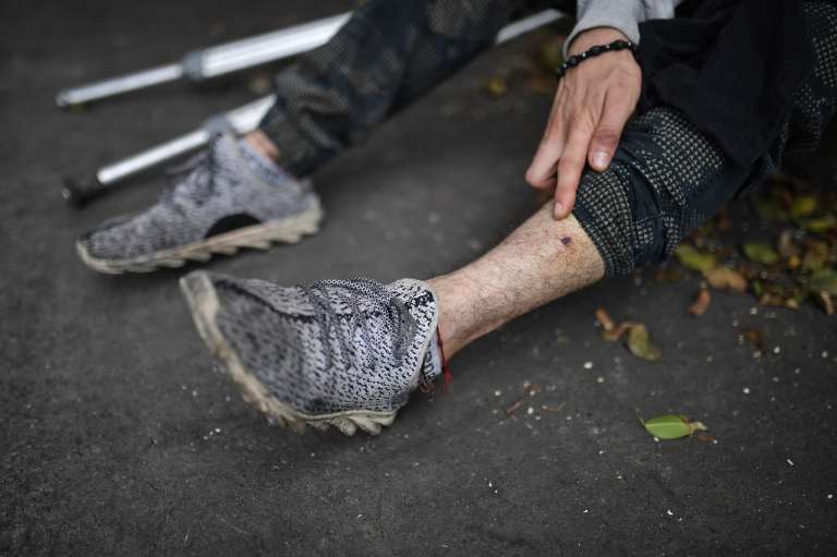 Con heridas, casquillos regados en el suelo y agujeros de bala en sus viviendas, pretender demostrar los malos procedimientos de los uniformados.