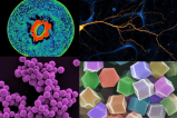 En imágenes: las sorprendentes fotos de ciencia microscópica