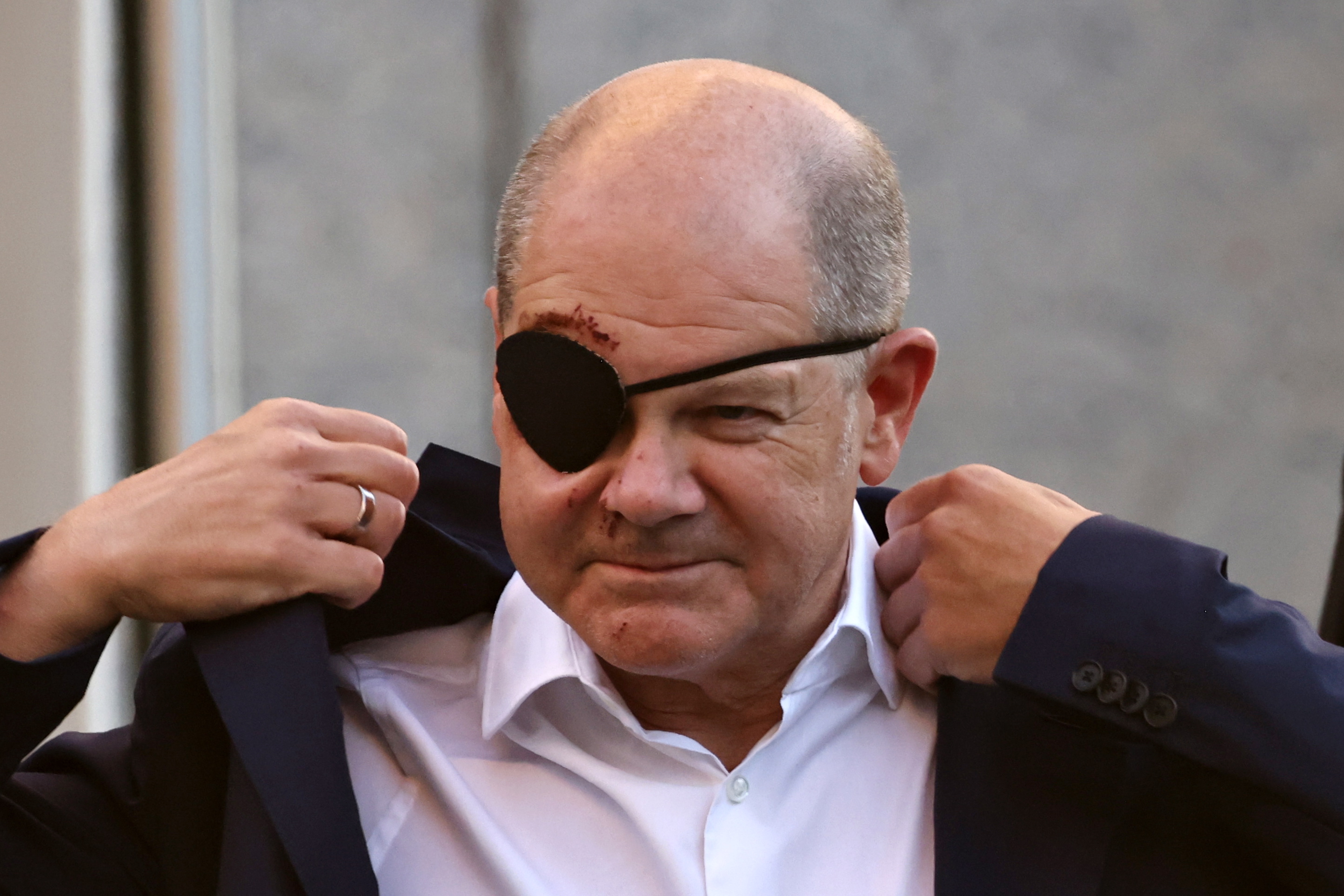 Berlin (Germany), 04/09/2023.- German Chancellor Olaf Scholz wears an eye patch as he arrives for the St. Michael annual reception at the Catholic Academy Conference Center in Berlin, Germany, 04 September 2023. German Chancellor Olaf Scholz made his first appearance at the St. Michael annual reception, after suffering facial injuries in a sports accident. An earlier post on 04 September 2023, on X (formerly known as Twitter) featured a photo portrait of him, wearing an eye patch and showing bruises, underlined by the writing: 'Whoever has the damage... Excited to see the memes. Thanks for the well wishes, looks worse than it is!'. (Alemania) EFE/EPA/CLEMENS BILAN
