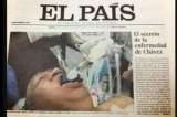 Foto que publicó diario español de Hugo Chávez intubado es falsa