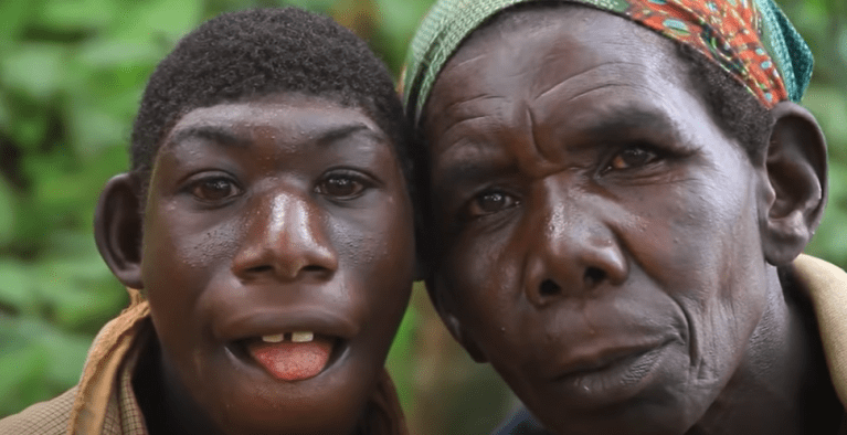 La historia de Ellie, un joven acosado y apodado como “el niño mono” en Ruanda