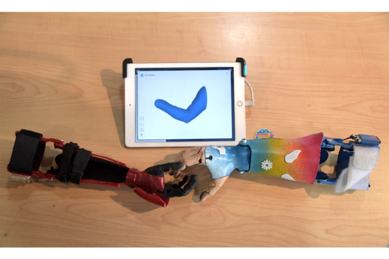 Fabrilab: Imprimir calidad de vida en 3D