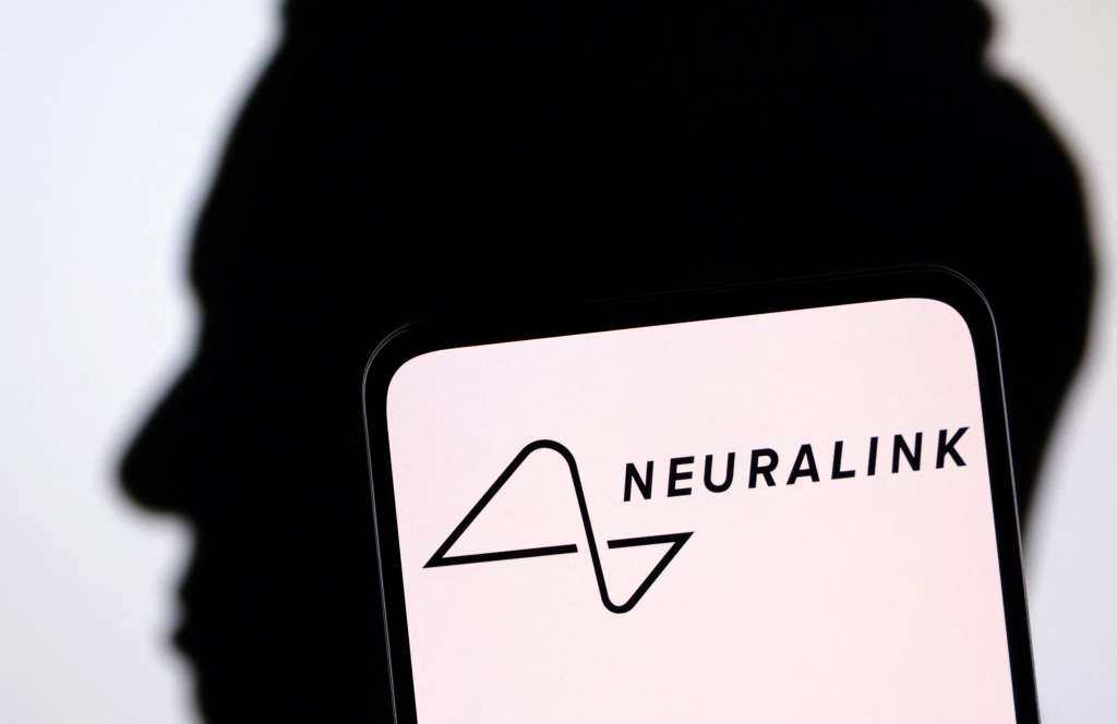 Neuralink, propiedad de Elon Musk, es una de las empresas que actualmente trabaja en crear implantes neuronales para humanos.