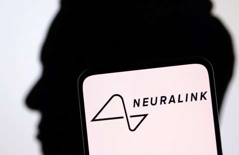 Este es el implante de Neuralink que permite jugar videojuegos solo con la mente