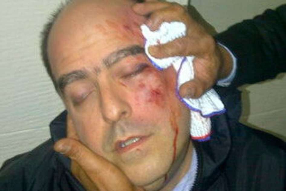 El diputado opositor Julio Borges, ensangrentado, golpeado en un ojo y con el pómulo izquierdo visiblemente hinchado tras pelea en la Asamblea Nacional.