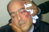 EE.UU., "muy preocupado" por violencia en parlamento venezolano