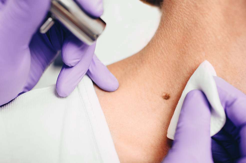 A pesar de todas las incógnitas que aún quedan por resolver, la posibilidad de que estos resultados se confirmen ha vuelto a poner en el centro de la discusión científica una idea que lleva años creciendo: la medicina personalizada.