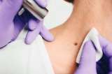 ¿Vio noticias sobre una nueva “vacuna” contra un cáncer? Acá le explicamos qué es y qué hace