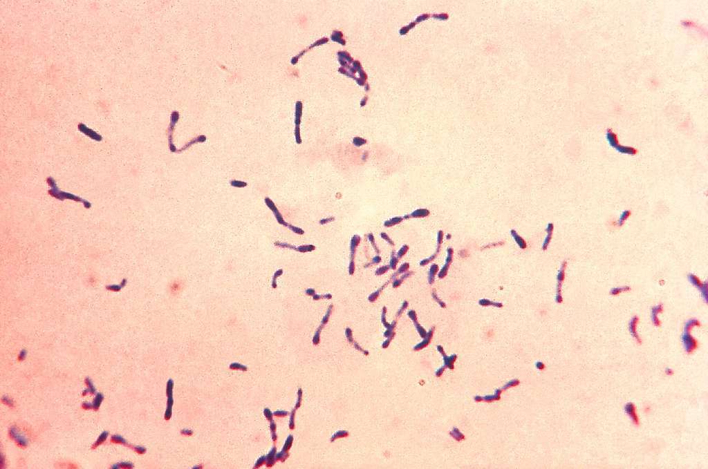 Imagen de la bacteria 'Corynebacterium diphtheria'.