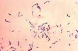 ¿La evolución de las bacterias puede ser predecible?