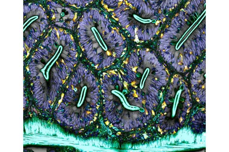 Red de macrófagos (glóbulos blancos) del intestino de un pez cebra adulto