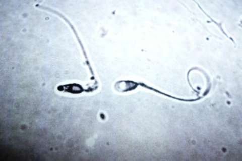 Según un estudio, la contaminación podría alterar la calidad del semen