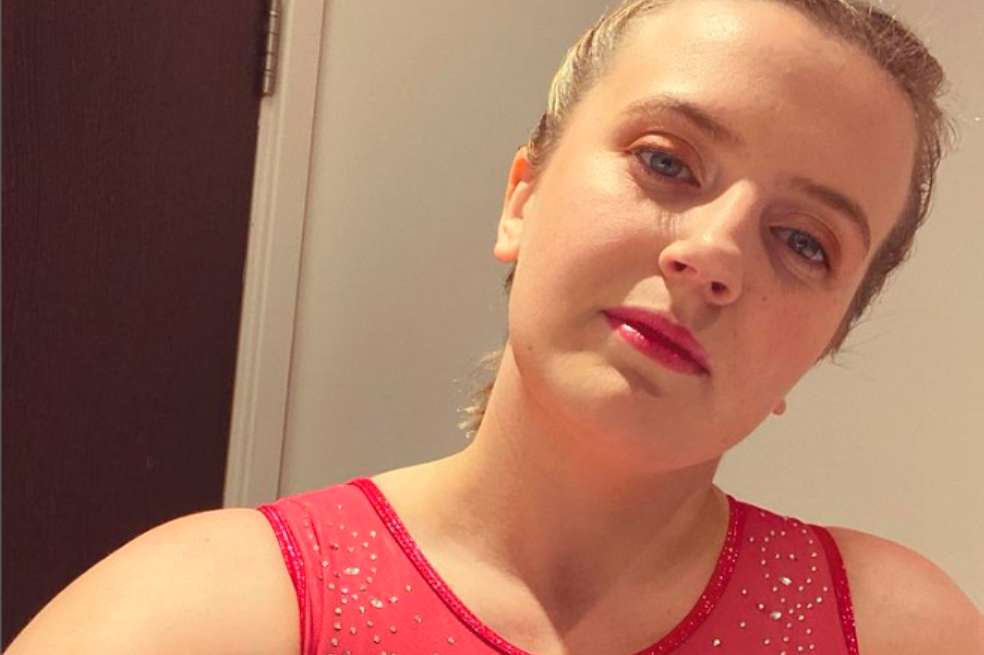 Alergia a las emociones: Esta mujer de 27 años no puede reír ni llorar Natasha Coates
