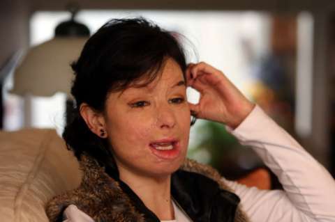Natalia Ponce será condecorada en Bogotá por su lucha contra los ataques con ácido