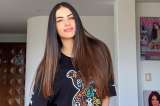 Jessica Cediel compartió duras imágenes de su proceso con los biopolímeros