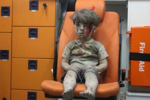 Murió Alí, hermano del pequeño Omran, víctima de la guerra en Siria