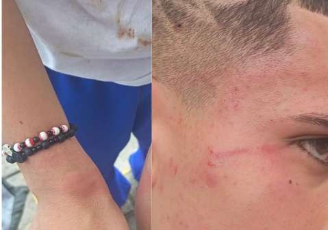 Menor denuncia agresiones en un CAI de Suba tras ser señalado de un apuñalamiento
